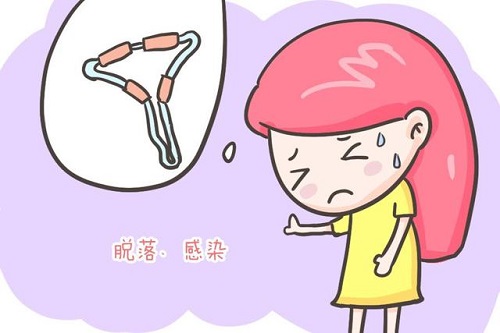 避孕環會有什么副作用 女性避孕環帶來的副作用一覽