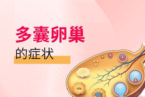 多囊卵巢怎么調理才能好 多囊卵巢要吃一輩子藥嗎