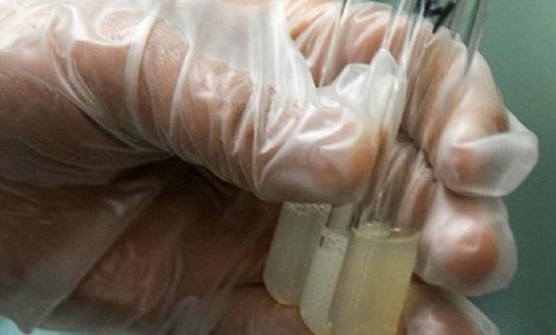 男性精液是否正常怎么判斷 本文分享8個方法判斷精液健康