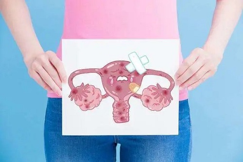 婦科疾病有哪些癥狀 本文盤點女性婦科疾病的癥狀