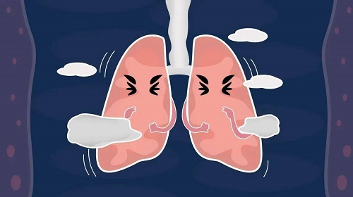 10秒自查肺部方法是什么 哪些方法可以自查肺部健康