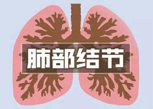 肺部結節最怕三個征兆是什么 如何讓肺部結節消失
