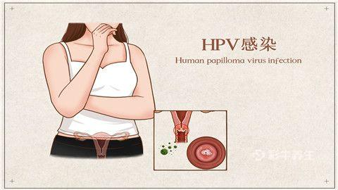 hpv自查的10個(gè)方法是什么 女性hpv最初的征兆有哪些