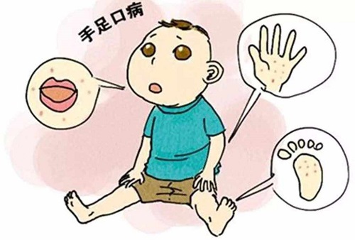 手足口病一般幾天能好 為啥會得手足口病
