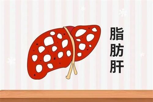 脂肪肝怎么調理最好最快 脂肪肝10大必吃食物是什么