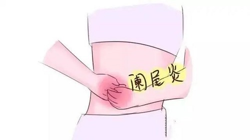 闌尾炎是哪個部位疼 闌尾炎一定要開刀嗎