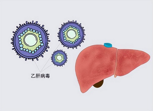 乙肝傳播途徑有幾種 乙肝是很嚴重的病嗎