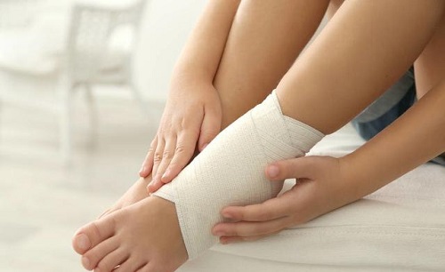 腳踝扭傷了腫了怎么恢復最快 腳崴了腫了能自愈嗎