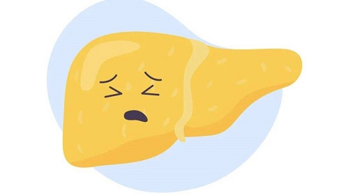 黃疸肝炎會傳染嗎 黃疸肝炎要怎么才能預防
