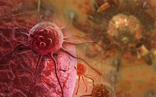 良性腫瘤與惡性腫瘤的區別是什么 良性腫瘤會變惡性嗎