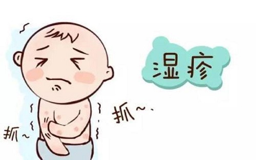 濕疹快速消退方法是什么 濕疹的引起原因是什么