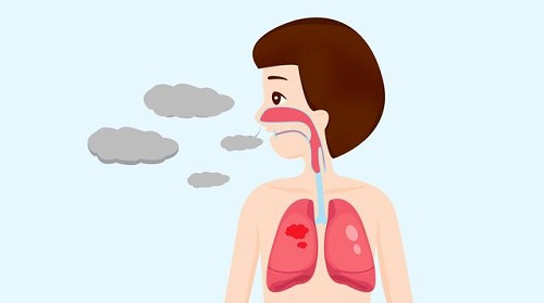 痰是怎樣形成的 喉嚨有痰怎樣去除最快
