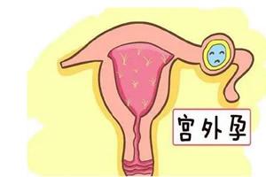 宮外孕后還能懷孕嗎 什么情況導致宮外懷孕