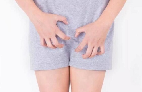 外陰瘙癢白帶豆腐渣是為什么 哪些原因導致女性外陰瘙癢白帶豆腐
