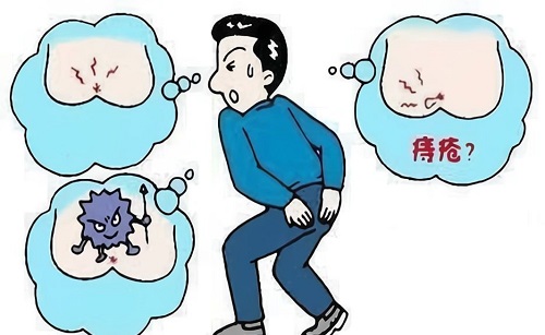 得痔瘡了如何自愈 痔瘡發作期間吃什么好