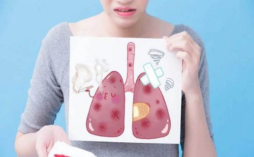 肺癌的早期癥狀和前兆是什么 盤點肺癌早期的具體癥狀與前兆