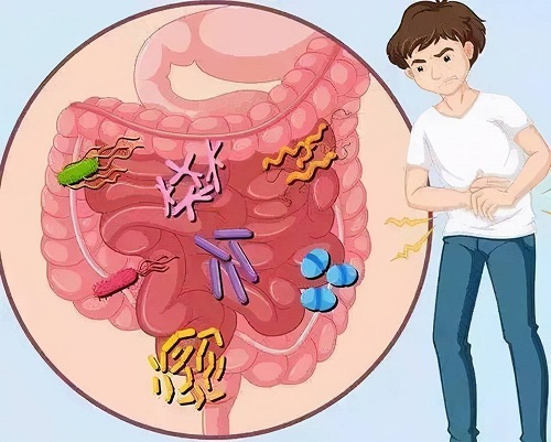 慢性結腸炎的癥狀是什么 慢性結腸炎癌變幾率大嗎