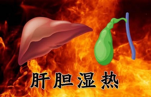 肝膽濕熱的癥狀是什么 女人肝膽濕熱的原因是什么