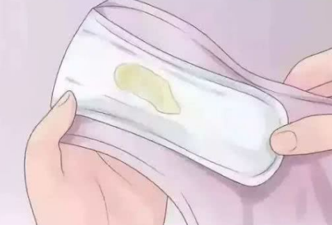 女生下面流黃水是什么原因引起的 女生下面流黃水可以自愈嗎