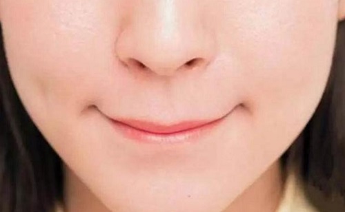 長期抿嘴會改善凸嘴嗎 嘴巴凸起怎么矯正