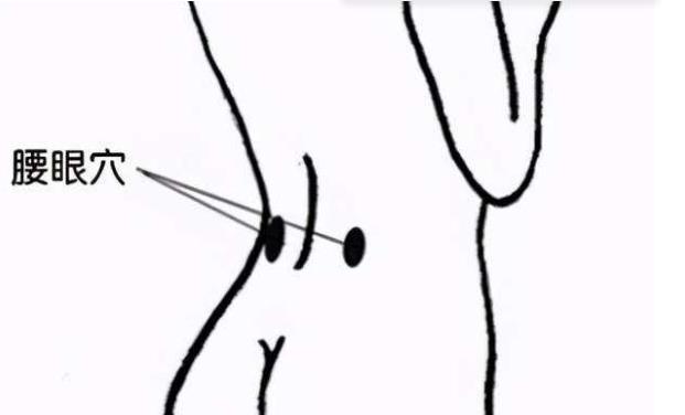 腰陽關(guān)在什么位置 女性腰陽關(guān)酸痛的原因