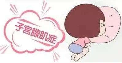 肌腺癥需要手術嗎 腺肌癥會癌變嗎