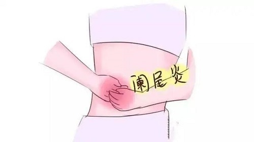闌尾炎是哪個部位疼 闌尾炎痛吃什么藥